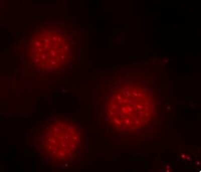 Immunocytochemistry/ Immunofluorescence: FOXO4 [p Ser197] Antibody - Azide and BSA Free [NBP3-05393]